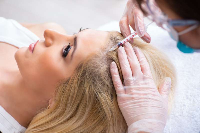 young woman receiving hair restoration treatment