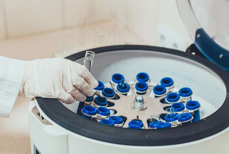 PRP centrifuge