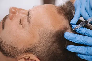 Hair Loss Treatment Waukesha County, WI