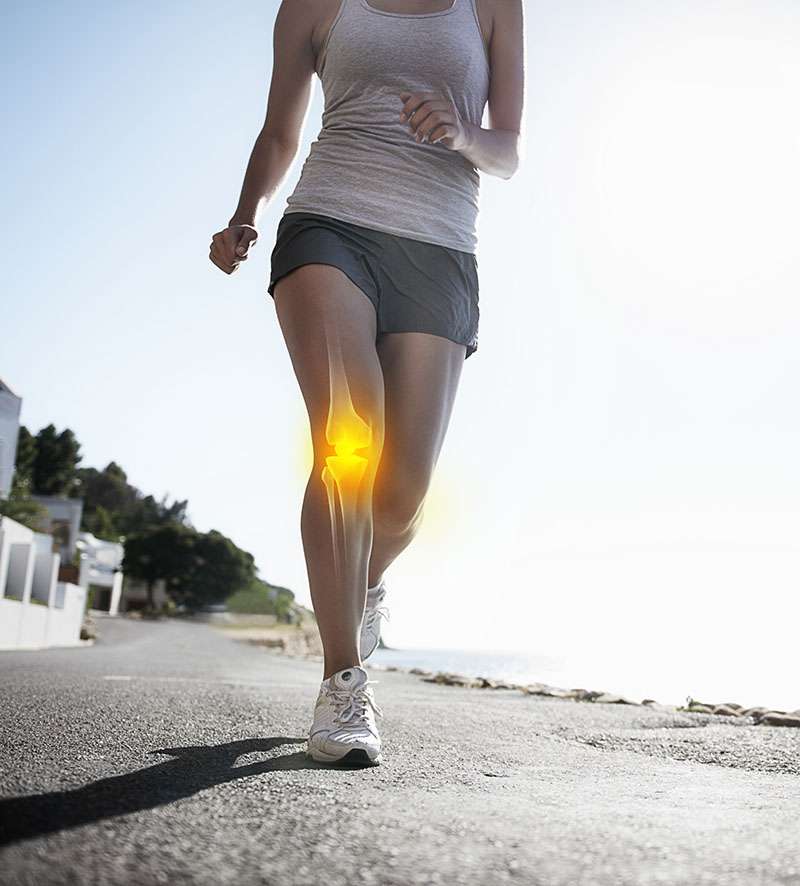 Woman, running and knee x ray for injury