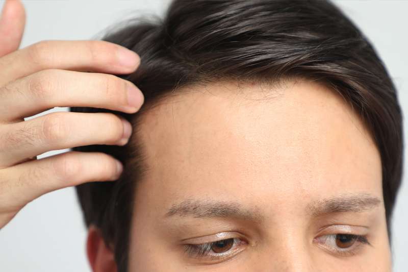 Young man's forehead looking at hair Young man's forehead looking at hair