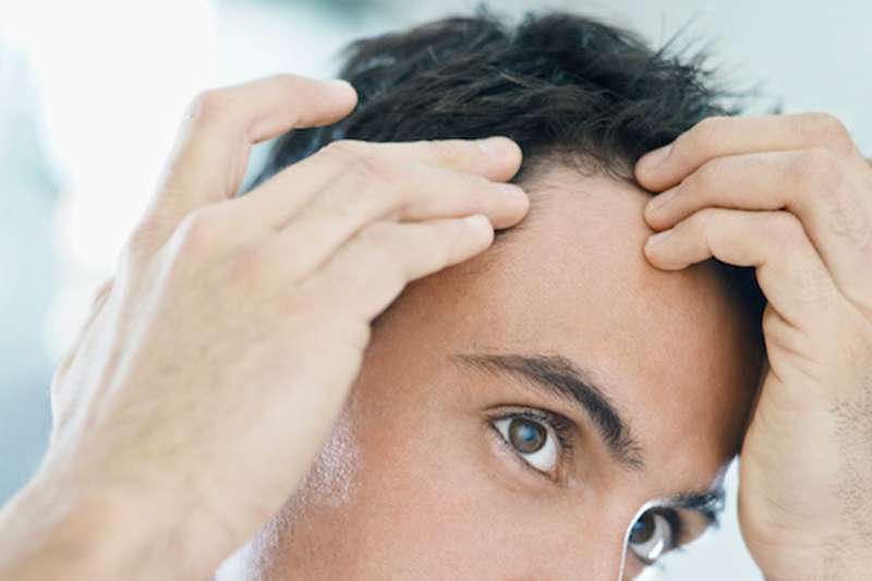 young male examining his thinning hair young male examining his thinning hair