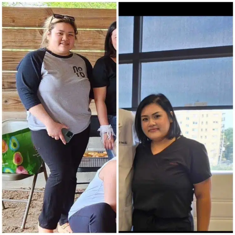 Weight Loss Before and After Photo by Forward Healthy Lifestyles in Germantown WI