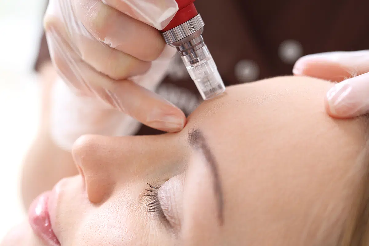Botox Injections Waukesha County, WI