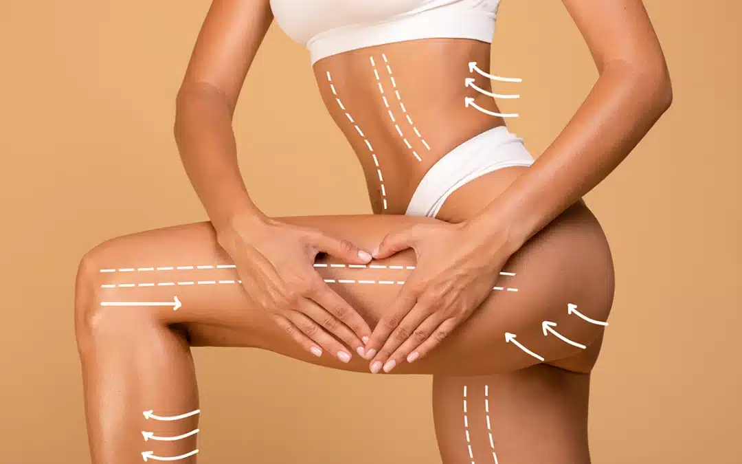Sculpt and Define: The Benefits of Body Contouring with BTL Exilis Ultra
