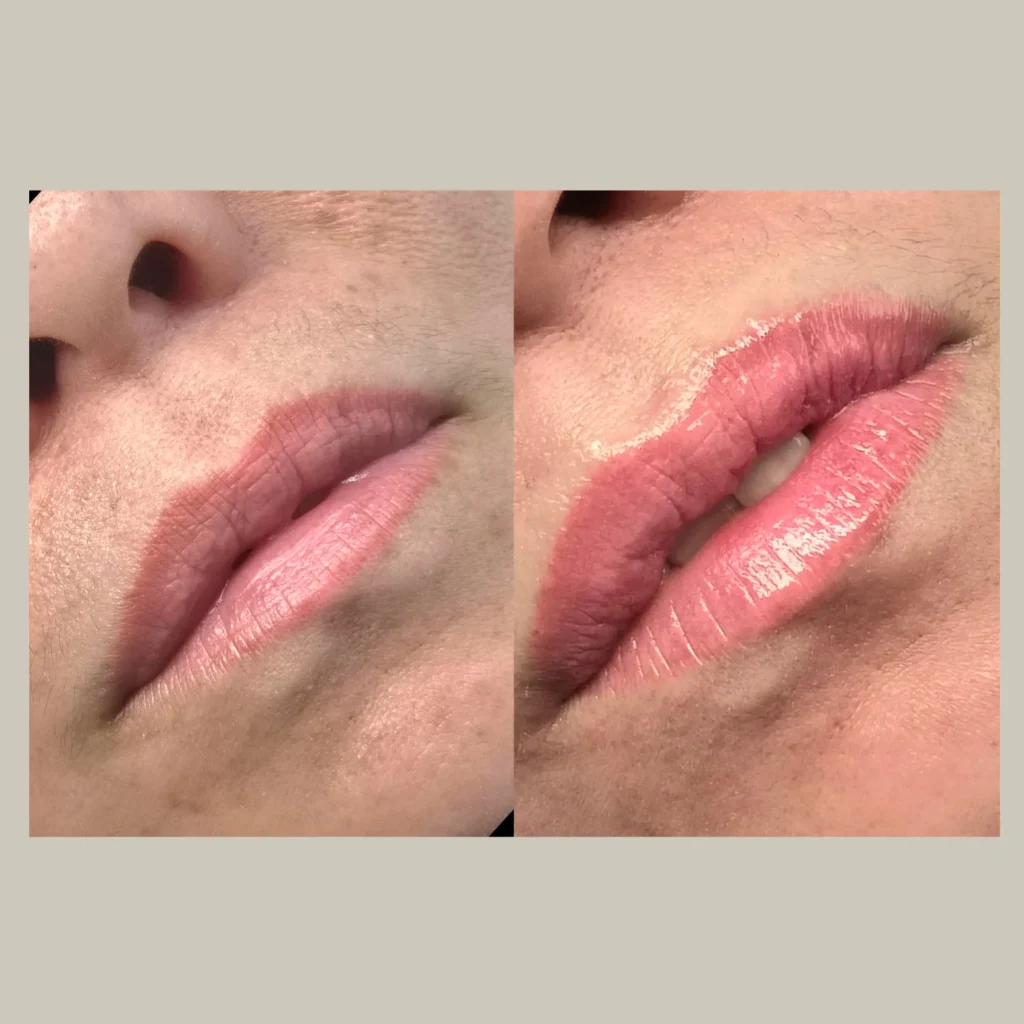 lip blush tinting before and after photo by forward healthy lifestyles in germantown wi