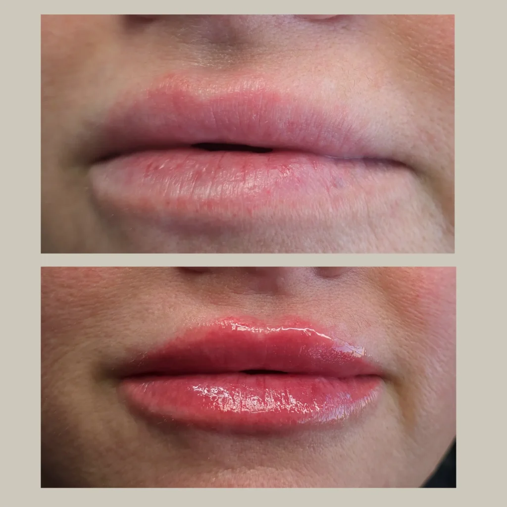 lip blush tinting before and after photo by forward healthy lifestyles in germantown wi