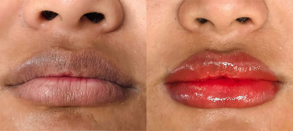 lip blushing before and after results